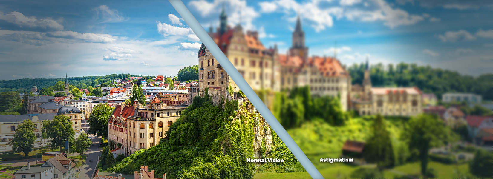 Astigmatism Treatment in Denton